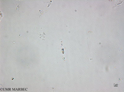 phyto/Brazilian_Amazon_coast/Amazomix_station_22/AMAZOMIX September 2021/Leptocylindrus danicus (St22_DCM_a_trouver220913_001_ovl-1).tif(copy)_thumb.jpg